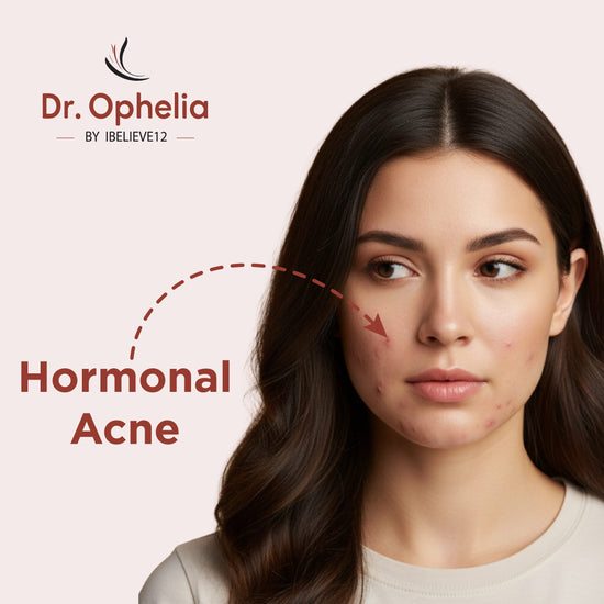 Acne Kit & Moistuzier