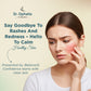 Acne Face Wash & Cream