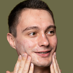 Pimples
